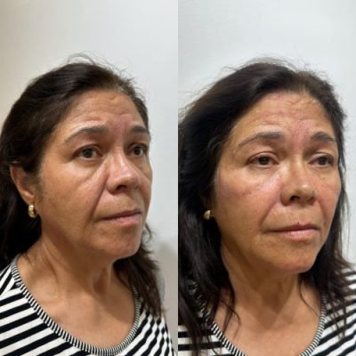 WhatsApp-Image-2025-08-21-at-18.26.09-scaled-rb1khnz3n3apz7ph42ms063jiz010le728j6fp5myw